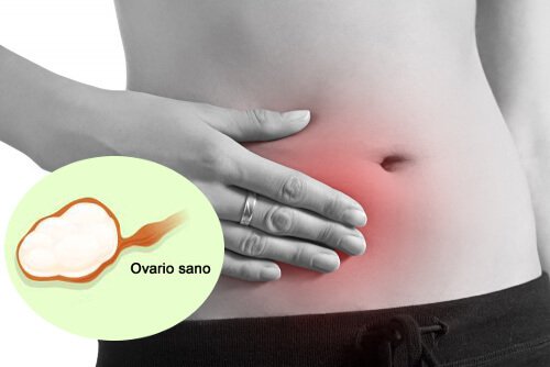 Kvinna med smärta i äggstockarna