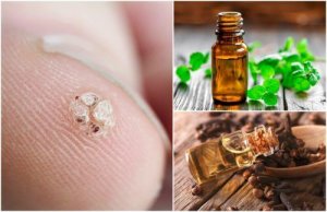 7 eteriska oljor som hjälper dig att bota vårtor