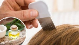 6 naturliga huskurer för att ta bort löss