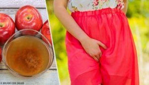 Naturliga kurer för vaginal sveda och klåda