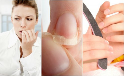8 anledningar till varför du har sköra naglar