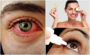 Torra ögon-syndromet: Hur man bekämpar det naturligt