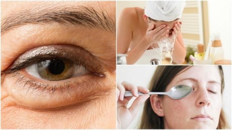 6 naturliga sätt att minska påsar under ögonen