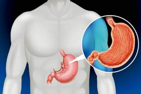 Man kan överleva utan mage