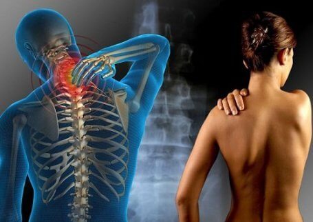 Viktiga saker du bör veta om fibromyalgi