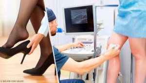 Behandla åderbråck med 3 naturliga kurer