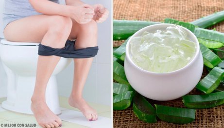 Behandling av hemorrojder: slipp det jobbiga problemet