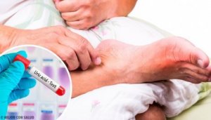 Fem vanliga orsaker till hög urinsyra