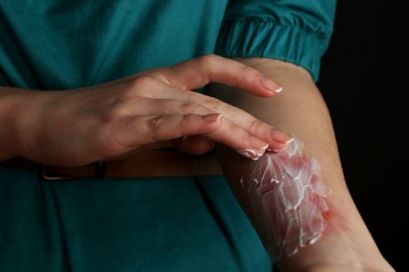 Person applicerar salva