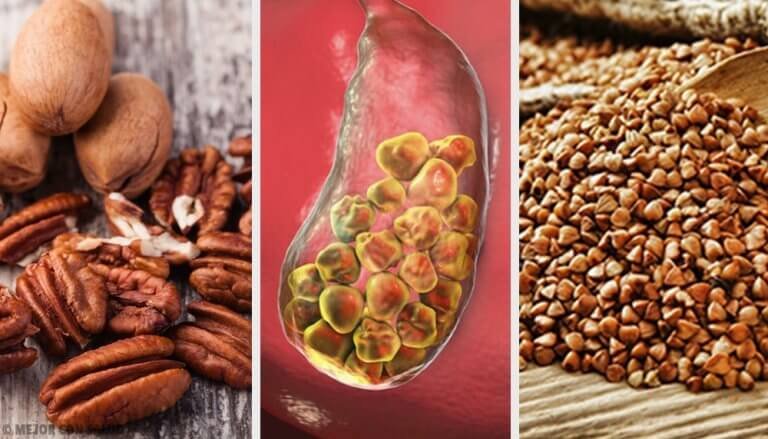 6 livsmedel som bekämpar gallsten