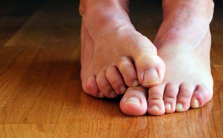 Det finns naturliga medel för att avlägsna svamp