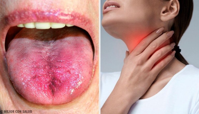6 sätt att veta om du har plack i halsen