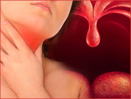 Kvinna som har ont i tonsillerna