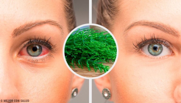 7 metoder för att behandla ögoninflammation naturligt