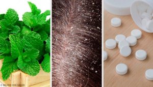 Naturliga huskurer mot mjäll - 7 enkla behandlingar