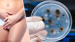 De vanligaste orsakerna till vaginala infektioner