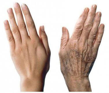 Så tar du hand om åldrande händer