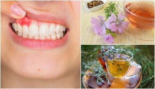 5 naturliga hemmakurer mot gingivit