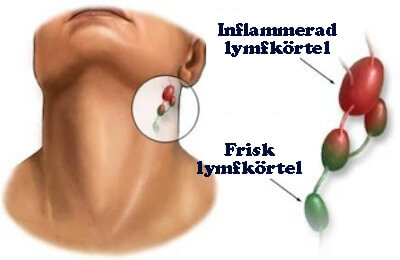 Lymfkörtlar