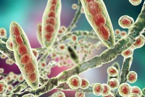 Lär dig att behandla fotsvamp med dessa huskurer