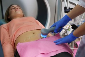 5 symptom på polycystiskt ovarialsyndrom