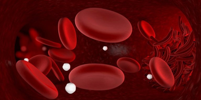 Tre mycket effektiva kurer för anemi