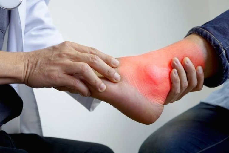 Utmärkta, naturliga kurer för inflammation