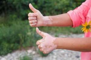 Autoimmun sjukdom: mat du bör äta respektive undvika