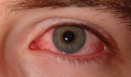 Rökning påverkar dina ögon