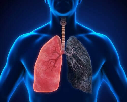 8 symtom på lunginflammation som du inte bör ignorera