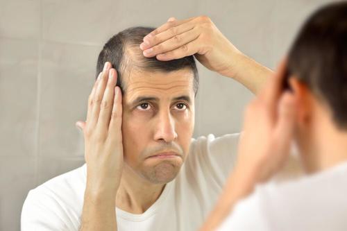 Alopeci kan leda till brist på självförtroende