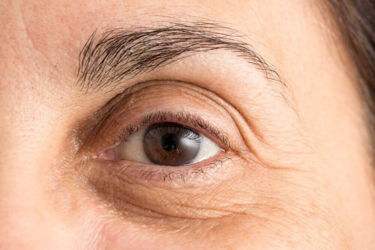 Undvik mörka ringar kring ögonen: 5 naturliga metoder