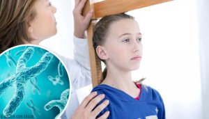 Allt du behöver veta om Turners syndrom