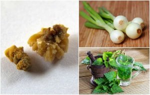 Bekämpa urinsyrakristaller med dessa naturliga huskurer