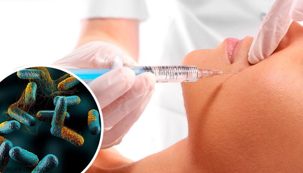 Botulinumtoxin - ett dödligt gift