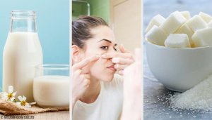 Bekämpa oren hy med dessa fyra masker