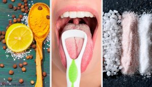 Naturliga huskurer för vit tunga - 4 enkla tips
