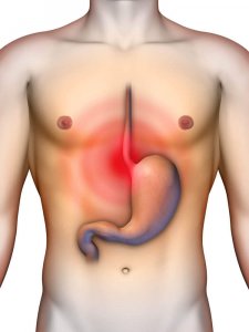 4 magsyraneutraliserande huskurer som kan lindra reflux