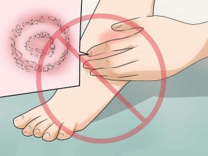 Hur man behandlar rosfeber: allt du behöver veta