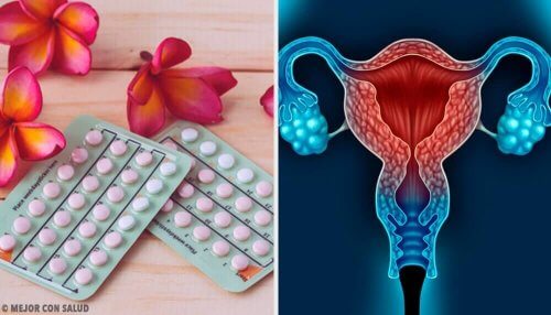 Lågt progesteron: komplikationer, orsaker och mer