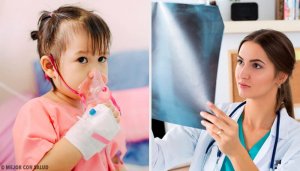 Allt du behöver veta om behandling av lunginflammation