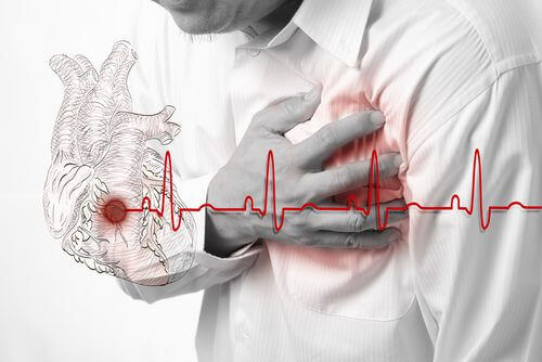 Arytmi påverkar både hjärtfrekvensen och -rytmen.