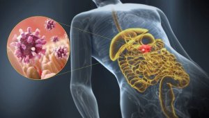 Lär dig om orsaker och symptom på gastroenterit