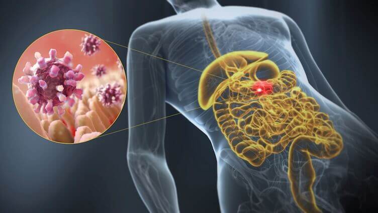 Lär dig om orsaker och symptom på gastroenterit