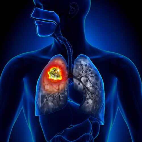 Schematisk bild av lungorna.