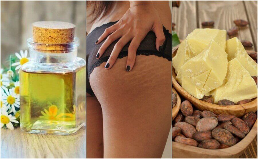 Reducera bristningar i huden med dessa 5 huskurer