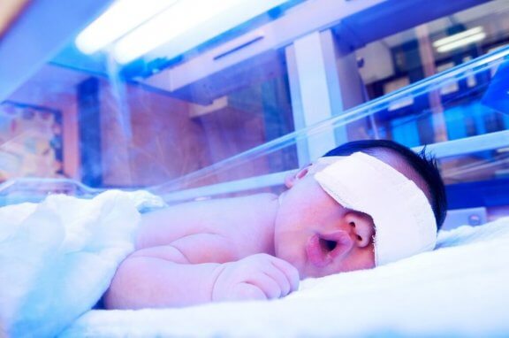 Bebis som genomgår fototerapi.