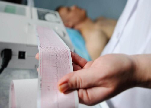 Vad ser man i ett EKG hos en person med hjärtinfarkt?