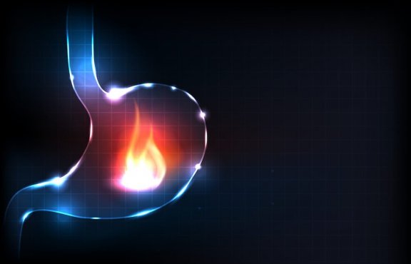 Effektiva och traditionella huskurer mot halsbränna.