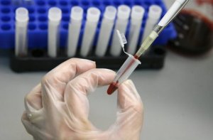 Stamcellstransplantation kan eliminera HIV